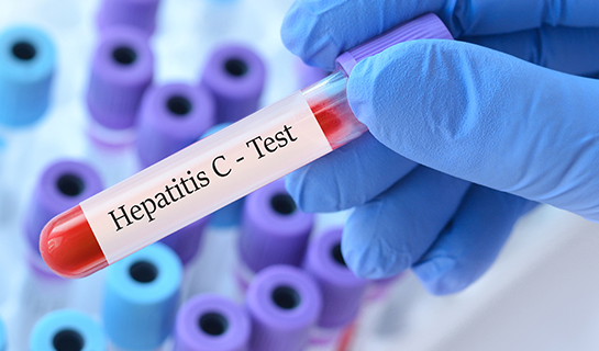 Hepatitis C Test